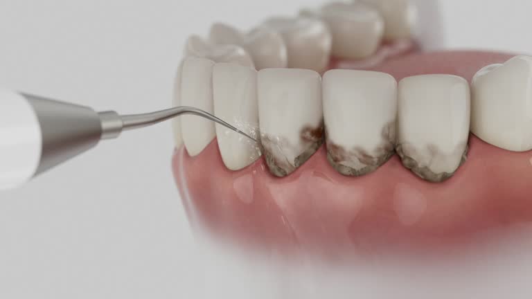 Reliable Dental Implants contractor in Pontotoc, MS by Smile Center Dentistry